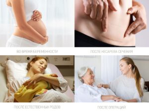 postpartum_pads_extra_32_879d7bb6a2 Прокладки Roxy Kids послеродовые EXTRA с бортиками и крылышками 32см, 10шт. 18